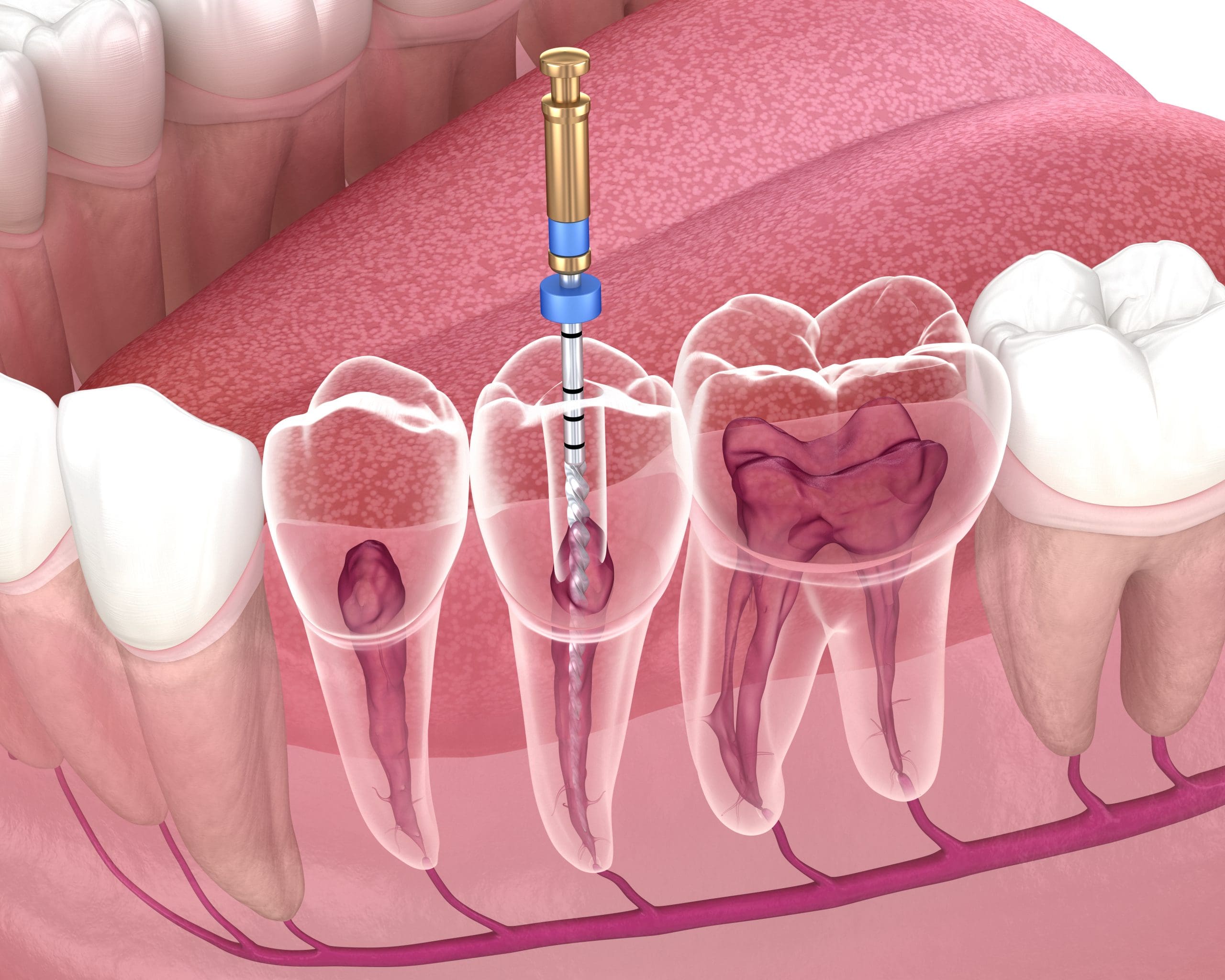 🧪 Endodonție